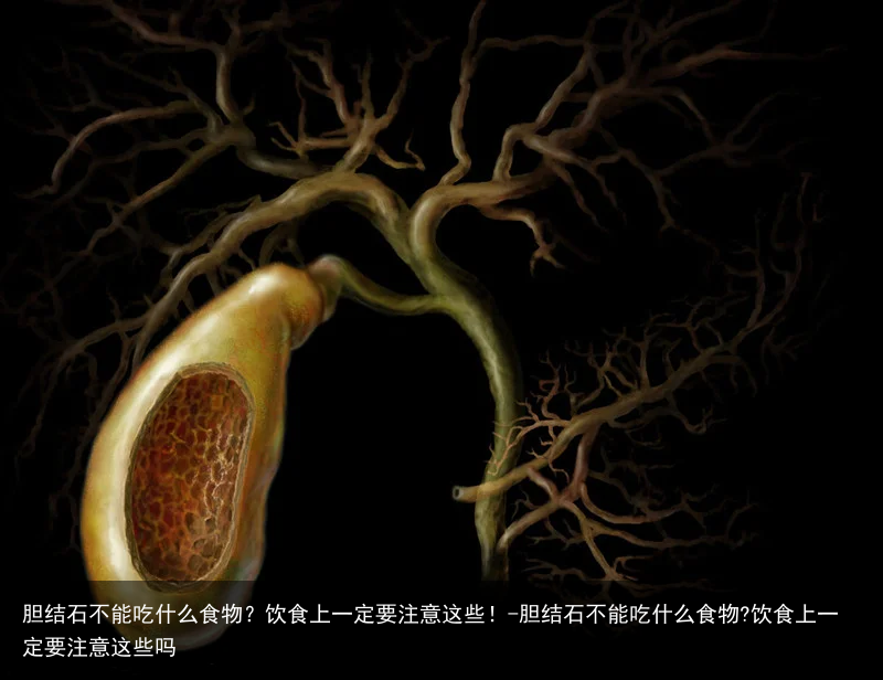 胆结石不能吃什么食物？饮食上一定要注意这些！-胆结石不能吃什么食物?饮食上一定要注意这些吗