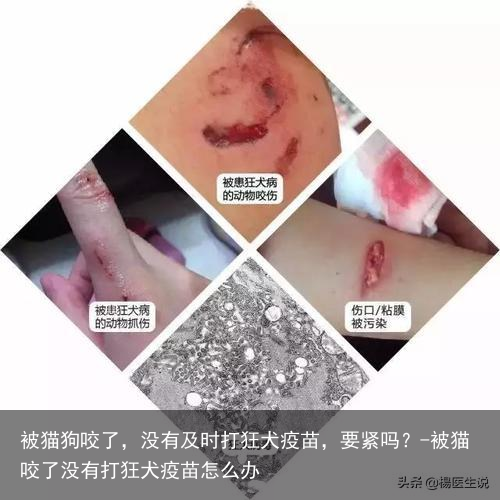 被猫狗咬了，没有及时打狂犬疫苗，要紧吗？-被猫咬了没有打狂犬疫苗怎么办