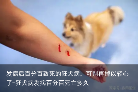 发病后百分百致死的狂犬病，可别再掉以轻心了-狂犬病发病百分百死亡多久