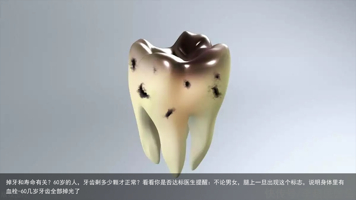 掉牙和寿命有关？60岁的人，牙齿剩多少颗才正常？看看你是否达标医生提醒：不论男女，腿上一旦出现这个标志，说明身体里有血栓-60几岁牙齿全部掉光了