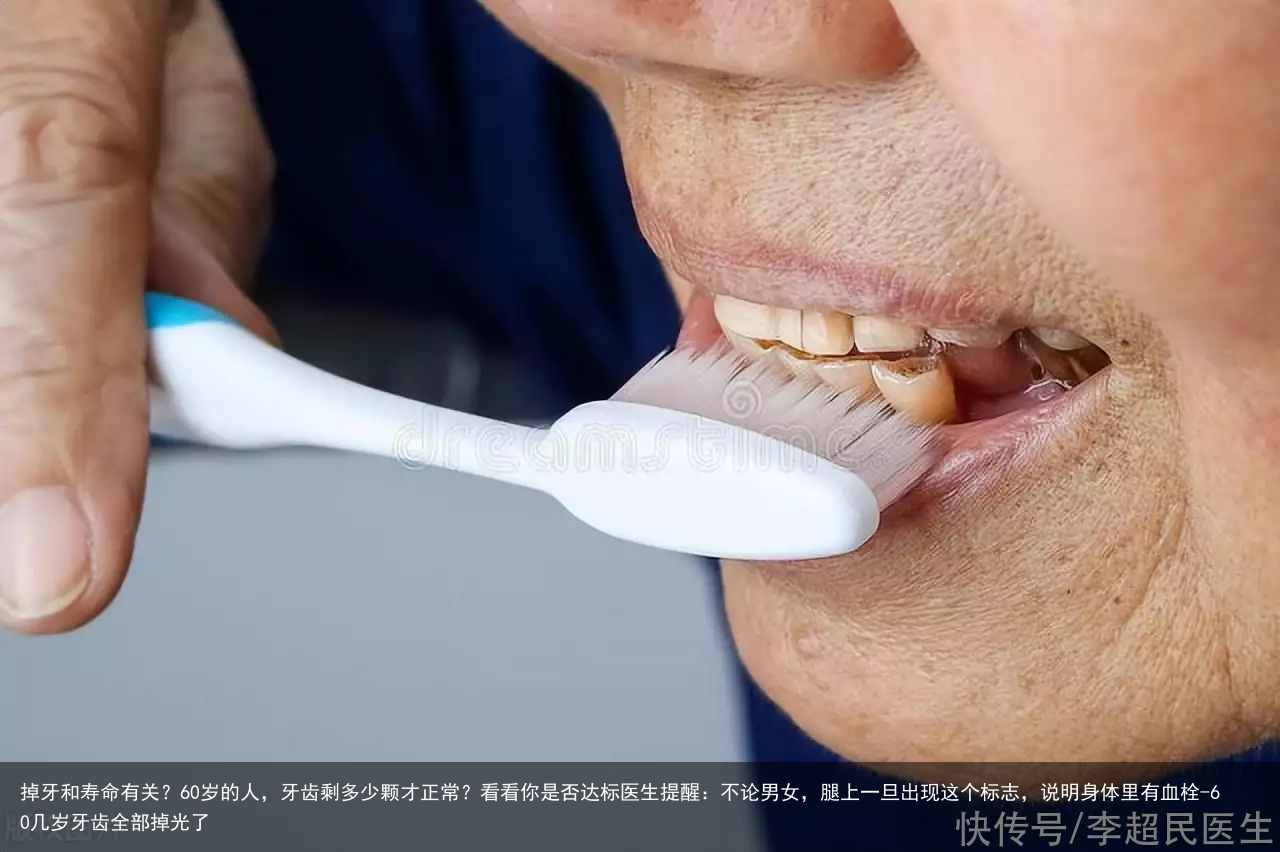 掉牙和寿命有关？60岁的人，牙齿剩多少颗才正常？看看你是否达标医生提醒：不论男女，腿上一旦出现这个标志，说明身体里有血栓-60几岁牙齿全部掉光了