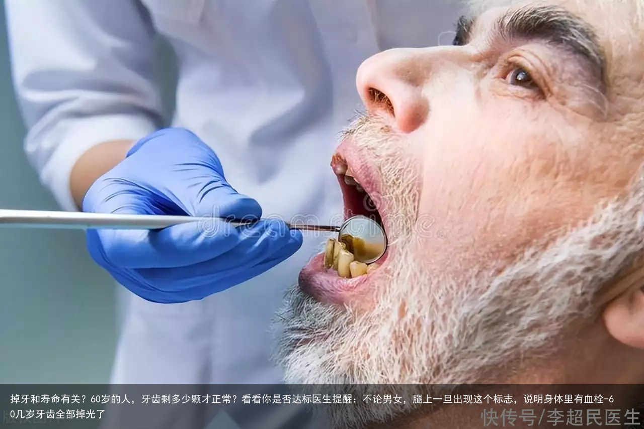 掉牙和寿命有关？60岁的人，牙齿剩多少颗才正常？看看你是否达标医生提醒：不论男女，腿上一旦出现这个标志，说明身体里有血栓-60几岁牙齿全部掉光了