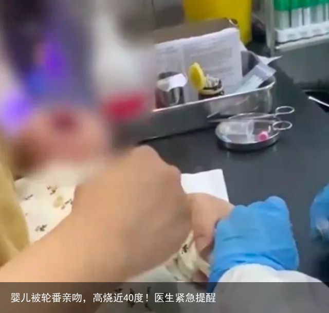 婴儿被轮番亲吻，高烧近40度！医生紧急提醒
