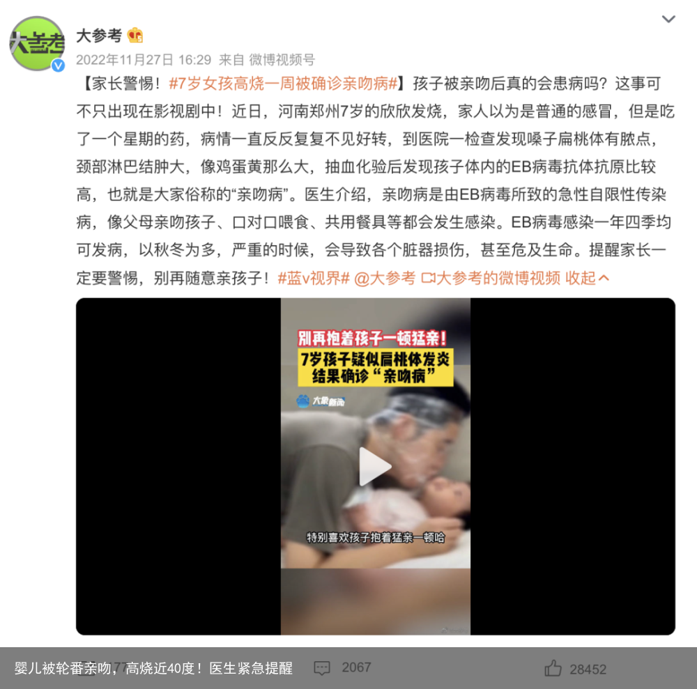 婴儿被轮番亲吻，高烧近40度！医生紧急提醒