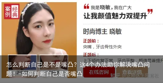 怎么判断自己是不是嘴凸？这4个办法助你解决嘴凸问题！-如何判断自己是否嘴凸