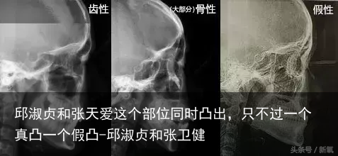 邱淑贞和张天爱这个部位同时凸出，只不过一个真凸一个假凸-邱淑贞和张卫健