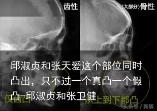 邱淑贞和张天爱这个部位同时凸出，只不过一个真凸一个假凸-邱淑贞和张卫健