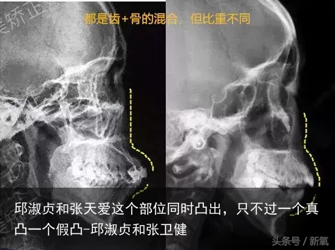 邱淑贞和张天爱这个部位同时凸出，只不过一个真凸一个假凸-邱淑贞和张卫健