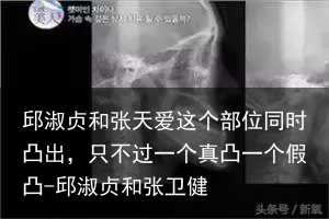 邱淑贞和张天爱这个部位同时凸出，只不过一个真凸一个假凸-邱淑贞和张卫健