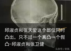邱淑贞和张天爱这个部位同时凸出，只不过一个真凸一个假凸-邱淑贞和张卫健