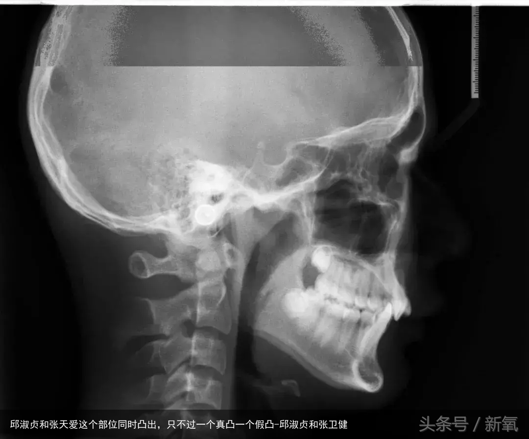 邱淑贞和张天爱这个部位同时凸出，只不过一个真凸一个假凸-邱淑贞和张卫健