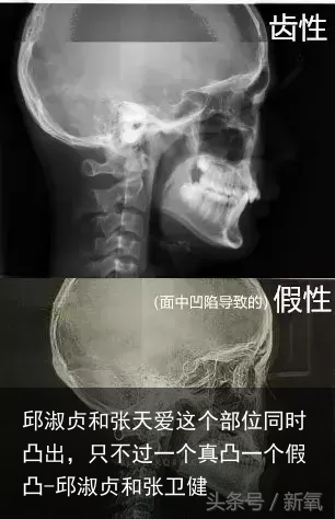 邱淑贞和张天爱这个部位同时凸出，只不过一个真凸一个假凸-邱淑贞和张卫健