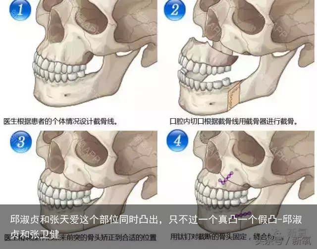 邱淑贞和张天爱这个部位同时凸出，只不过一个真凸一个假凸-邱淑贞和张卫健