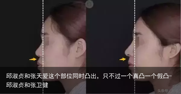 邱淑贞和张天爱这个部位同时凸出，只不过一个真凸一个假凸-邱淑贞和张卫健