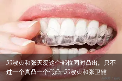 邱淑贞和张天爱这个部位同时凸出，只不过一个真凸一个假凸-邱淑贞和张卫健