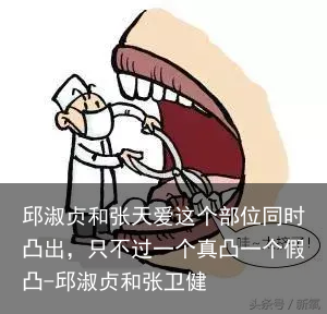 邱淑贞和张天爱这个部位同时凸出，只不过一个真凸一个假凸-邱淑贞和张卫健