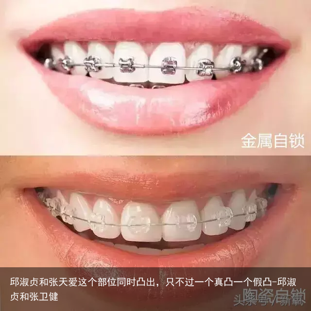 邱淑贞和张天爱这个部位同时凸出，只不过一个真凸一个假凸-邱淑贞和张卫健