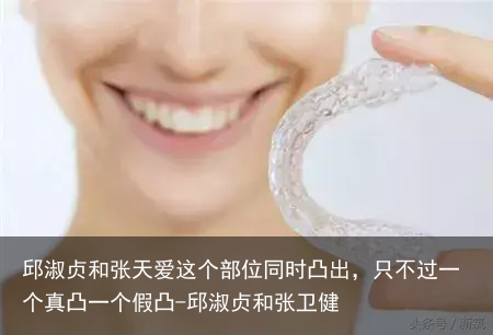 邱淑贞和张天爱这个部位同时凸出，只不过一个真凸一个假凸-邱淑贞和张卫健
