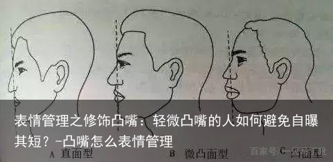表情管理之修饰凸嘴：轻微凸嘴的人如何避免自曝其短？-凸嘴怎么表情管理