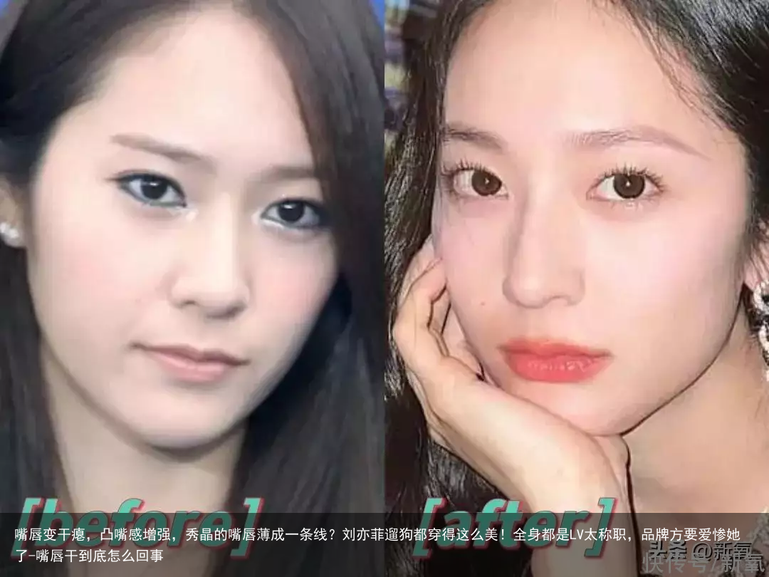 嘴唇变干瘪，凸嘴感增强，秀晶的嘴唇薄成一条线？刘亦菲遛狗都穿得这么美！全身都是LV太称职，品牌方要爱惨她了-嘴唇干到底怎么回事