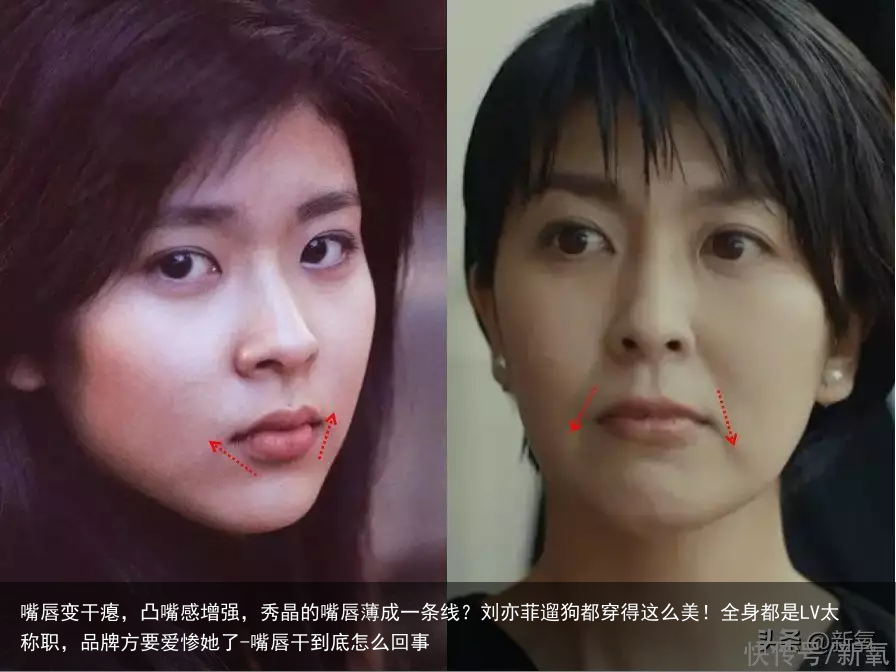 嘴唇变干瘪，凸嘴感增强，秀晶的嘴唇薄成一条线？刘亦菲遛狗都穿得这么美！全身都是LV太称职，品牌方要爱惨她了-嘴唇干到底怎么回事