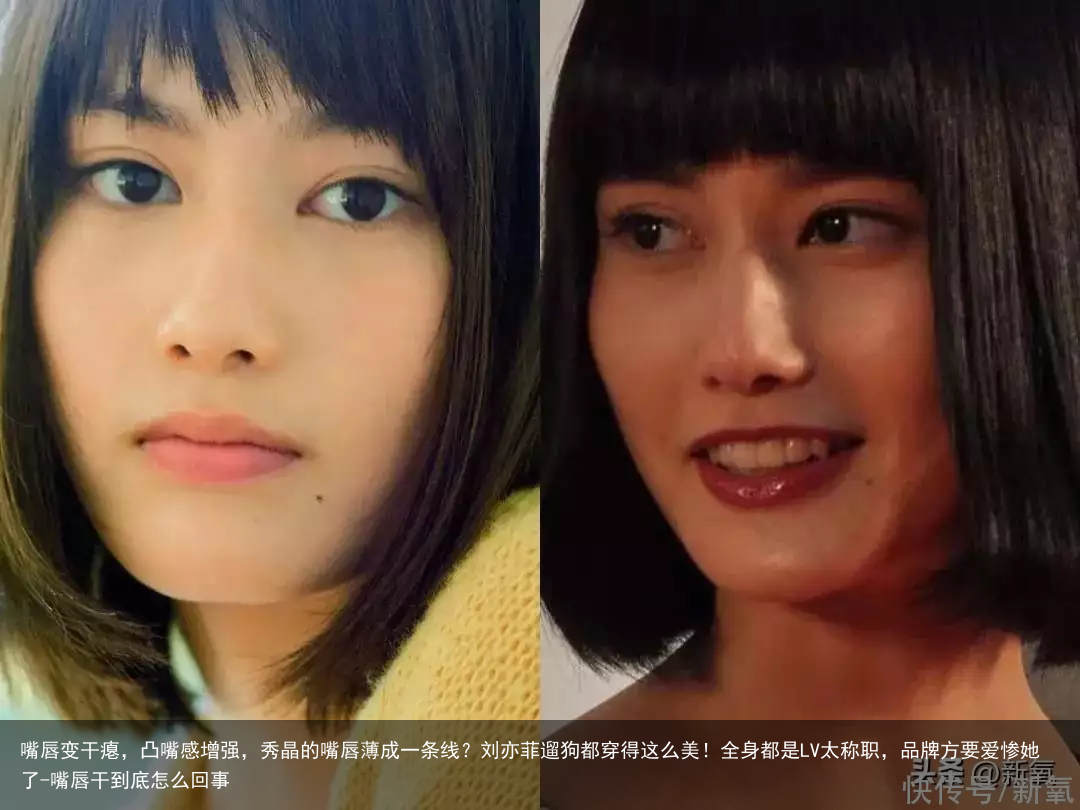 嘴唇变干瘪，凸嘴感增强，秀晶的嘴唇薄成一条线？刘亦菲遛狗都穿得这么美！全身都是LV太称职，品牌方要爱惨她了-嘴唇干到底怎么回事