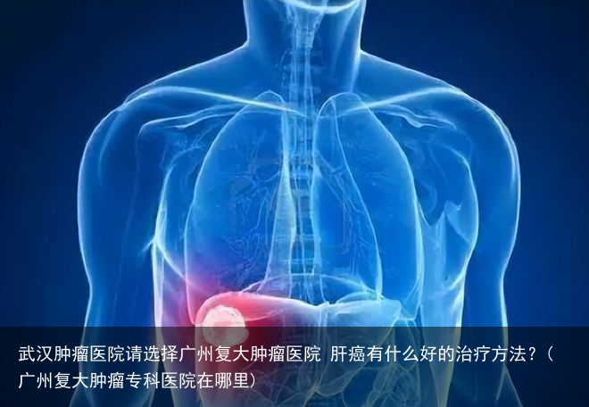 武汉肿瘤医院请选择广州复大肿瘤医院 肝癌有什么好的治疗方法？(广州复大肿瘤专科医院在哪里)