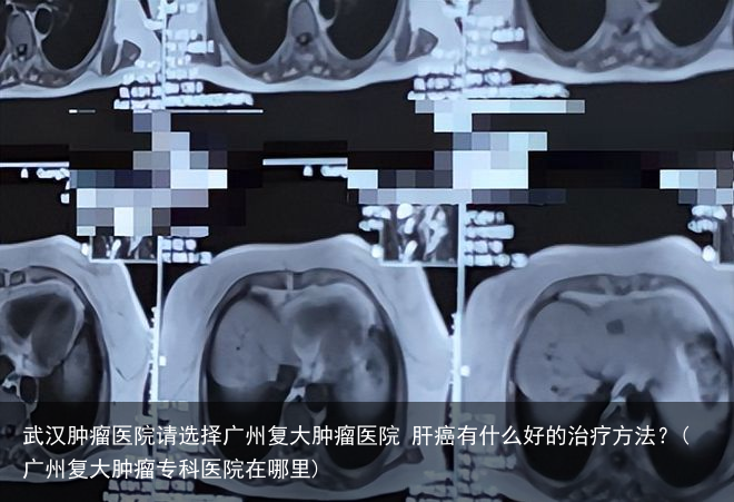 武汉肿瘤医院请选择广州复大肿瘤医院 肝癌有什么好的治疗方法？(广州复大肿瘤专科医院在哪里)