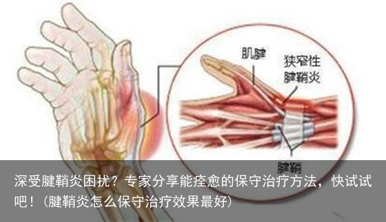 深受腱鞘炎困扰？专家分享能痊愈的保守治疗方法，快试试吧！(腱鞘炎怎么保守治疗效果最好)