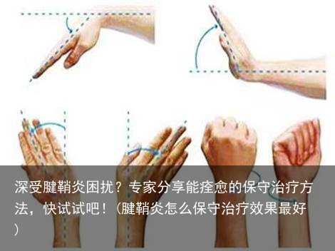 深受腱鞘炎困扰？专家分享能痊愈的保守治疗方法，快试试吧！(腱鞘炎怎么保守治疗效果最好)