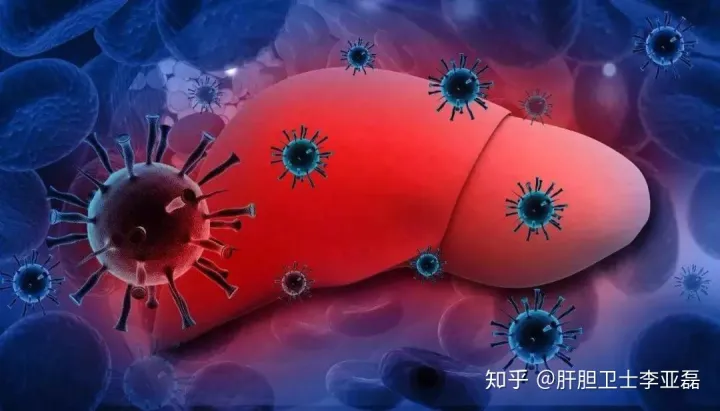 肝上有结节怎么治疗？(肝部结节病治疗)