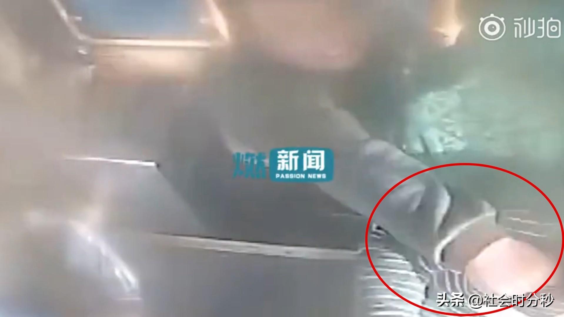 气愤！男子因1元车费对女司机动粗致其视网膜破裂 女司机或将失明（一元云车）