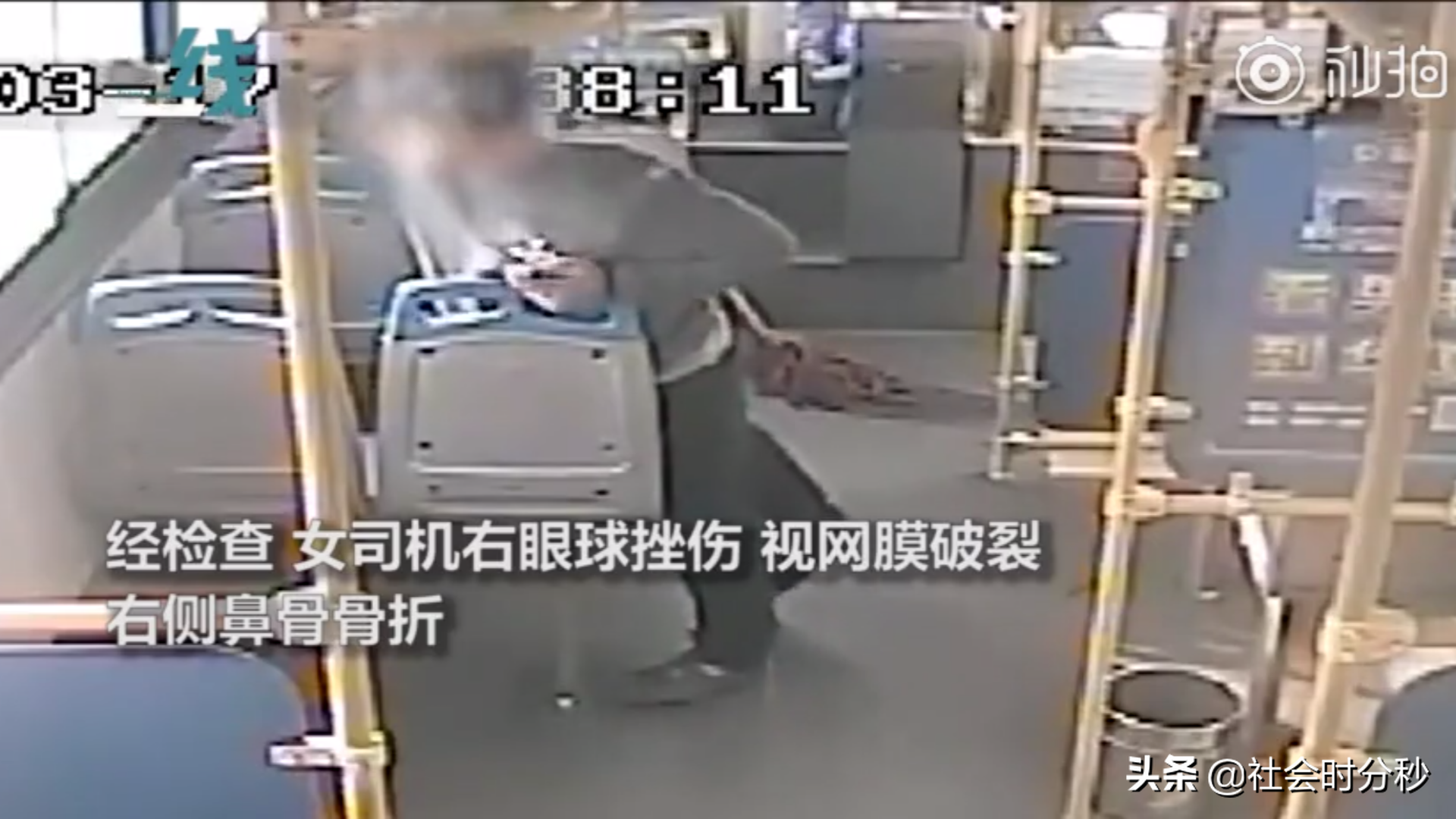气愤！男子因1元车费对女司机动粗致其视网膜破裂 女司机或将失明（一元云车）