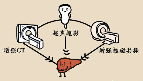 世界肝炎日 | 体检发现肝脏结节怎么办？这个检查最靠谱！