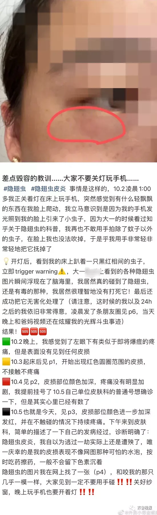 只因一条小虫，女子差点毁容！看完后怕…（一条虫打一成语是什么成语）