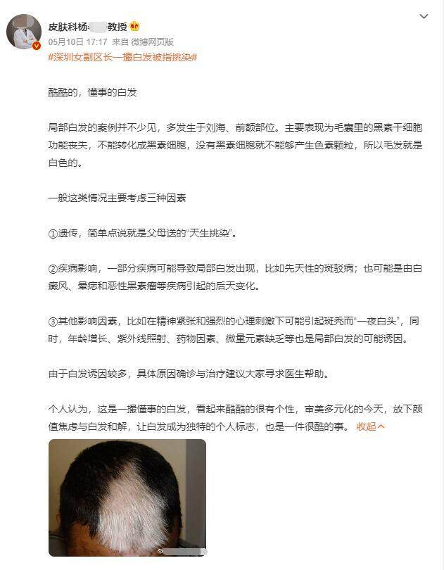 女副区长 “一撮白发”上热搜，压力大会导致白发提早或增多？（女区长被家暴致死最终判决）