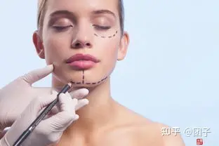 调查：筋膜悬吊面部提升术保持多久？筋膜提拉一般多少钱-筋膜悬吊术是拉皮吗