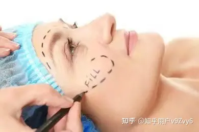 筋膜提拉术手术全过程，筋膜提升恢复期多长时间~-筋膜提拉术到底好不好