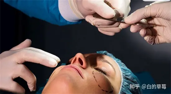 筋膜提升术、面部筋膜提升术能保持多久-面部松弛下垂提升最有效的方法