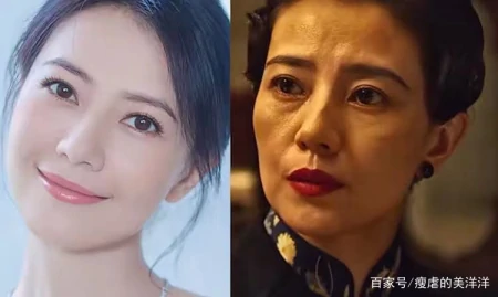 抗衰干货，如何改善面部下垂？-如何抵抗面部下垂