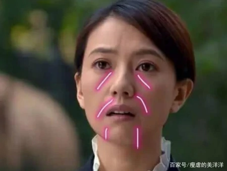 抗衰干货，如何改善面部下垂？-如何抵抗面部下垂