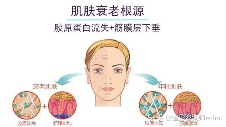 面部提升价格大概是多少？-面部提升怎么样