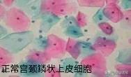梅艳芳生命中最后的痛，几人能懂？-梅艳芳最欣赏的三个男人