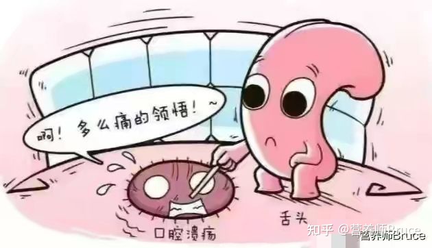 口腔溃疡有什么快速疗法？-口腔溃疡怎冶疗最好