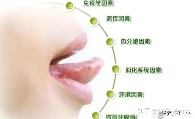 口腔溃疡有什么快速疗法？-口腔溃疡怎冶疗最好