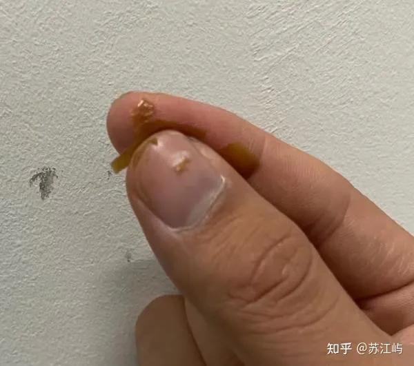 口腔溃疡怎么好得快？亲测多种治疗口腔溃疡有效的办法！-口腔溃疡怎么能尽快好