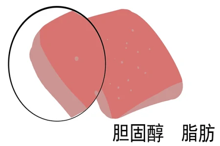 胆固醇高就不能吃鸡蛋和肉类？关于胆固醇，不少人有认知误区（胆固醇高不能吃鸡蛋对吗）