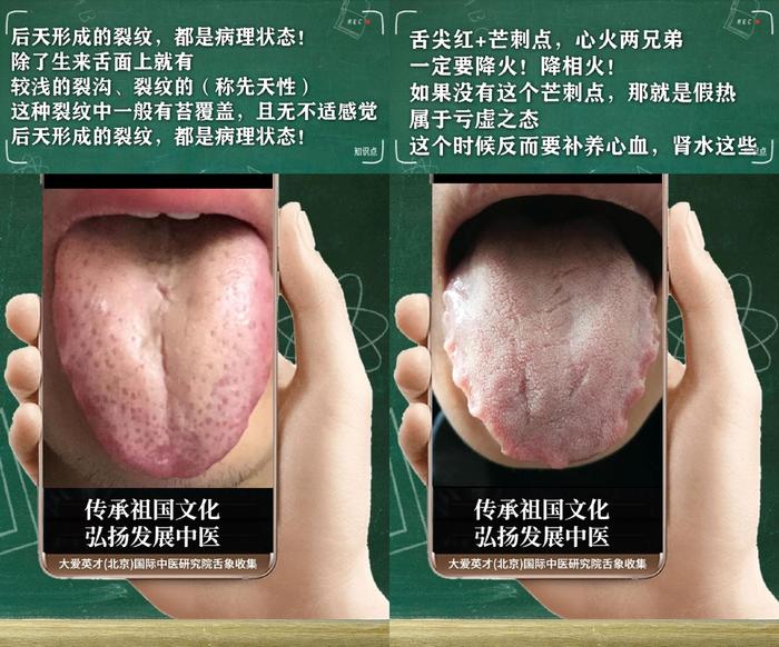 舌诊分析：生气、睡眠紊乱、水湿上泛、忽好忽坏很受影响-生气用中医学怎么说