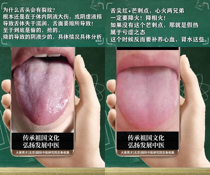 舌诊分析：生气、睡眠紊乱、水湿上泛、忽好忽坏很受影响-生气用中医学怎么说