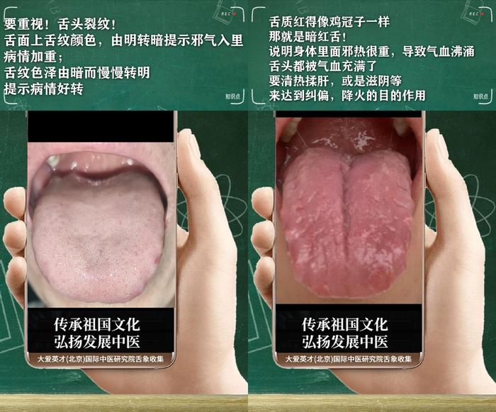 舌诊分析：生气、睡眠紊乱、水湿上泛、忽好忽坏很受影响-生气用中医学怎么说